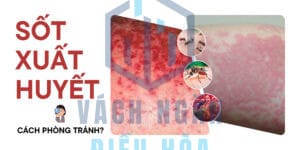 Trieu-chung-sot-xuat-huyet-